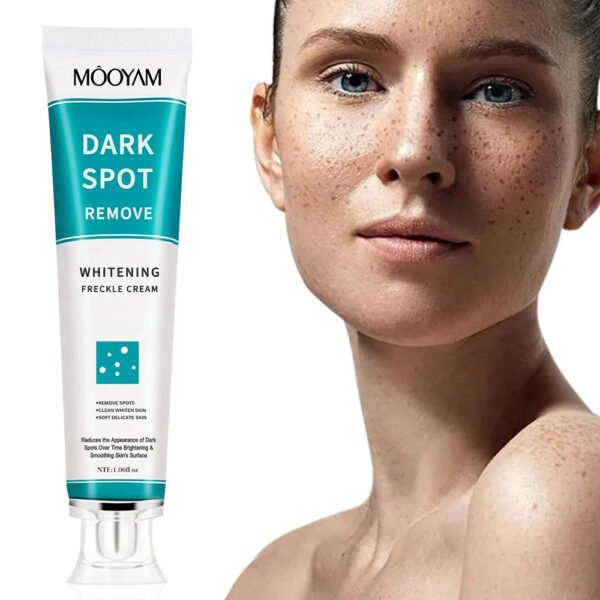 MOOYAM Dark Spot & Freckle Correcting Cream