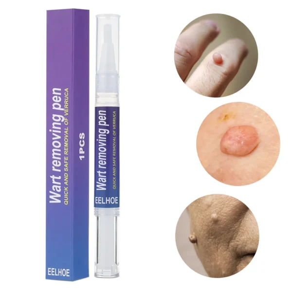 EELHOE Wart Removing Pen